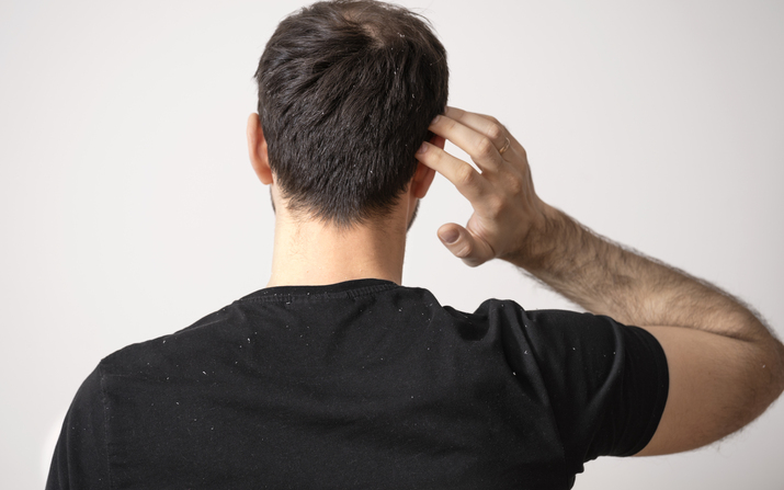 Gözden kaçan saç dökülmesinin sebepleri ve önleme yolları