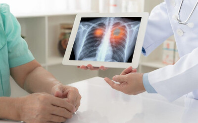 Bronkoskopi ile akciğer hastalıklarında hem tanı hem tedavi