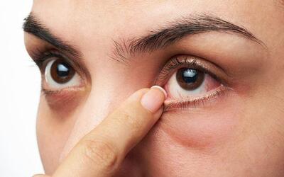 Gözde sessiz tehlike: ‘Retina dekolmanı’ belirtilerine dikkat!